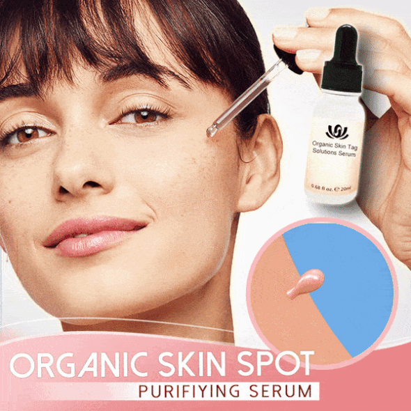 🔥FREE SHIPPING🔥 Organic Spot Free Serum