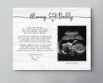 Personalized Mothers Day Canvas, Gift For Mom From Son, New Baby Announcement Ultrasound Scan Canvas