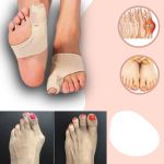 FeelGreat Orthopedic Toe Bunion Corrector 2.0 - 1 Pair (Left + Right)