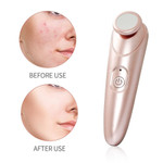 Ozone Acne Removal Plasma Pen - menzessential