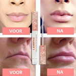 Smooxy™ - Volle Lippen Serum - Webwinkelaar.nl